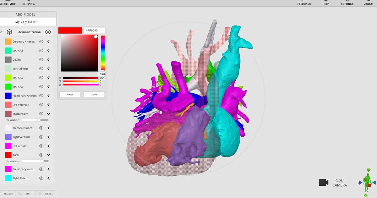 Rady Children's debuts free 3D image viewing software, available for other providers